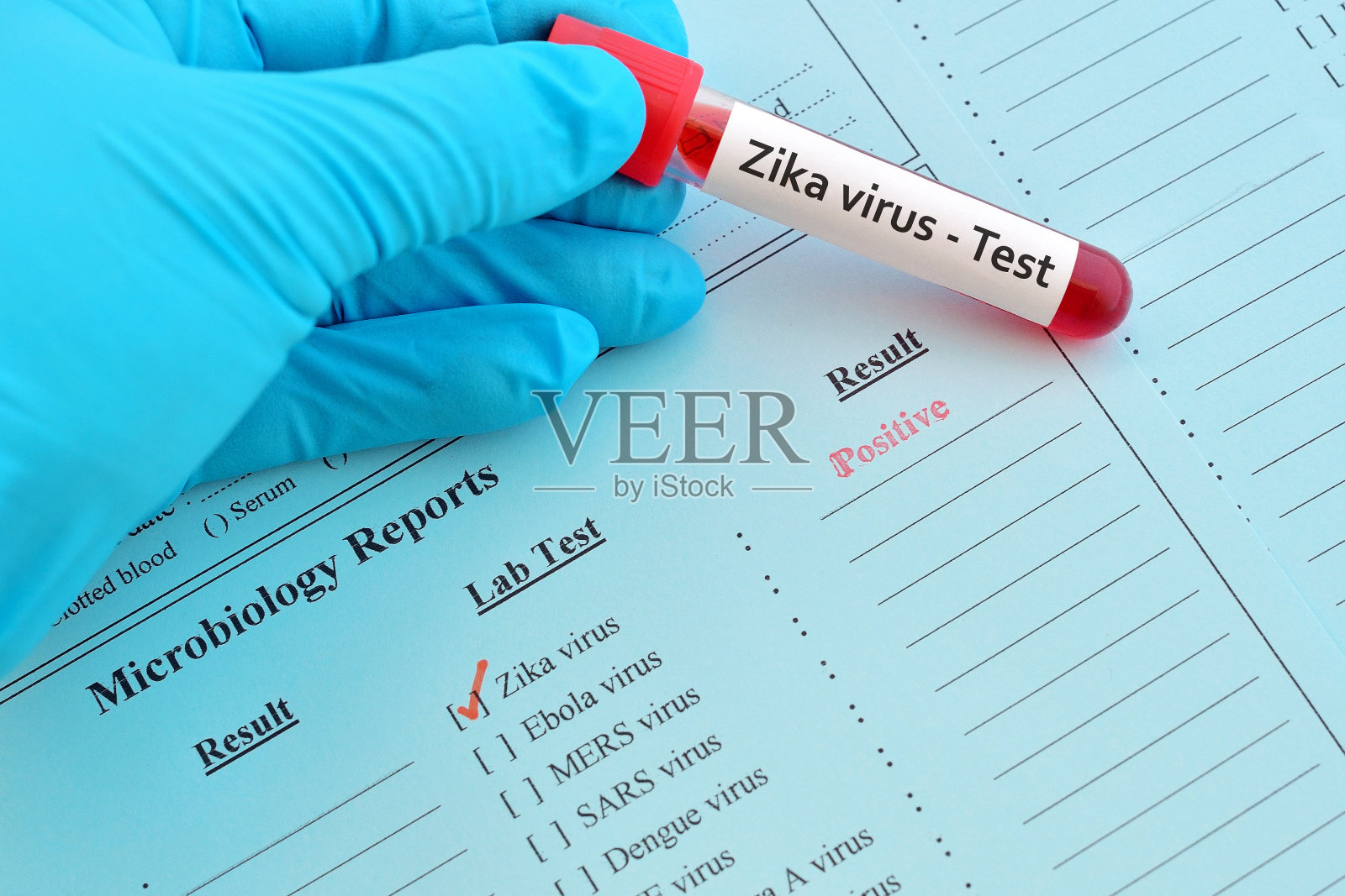 Zika病毒阳性照片摄影图片