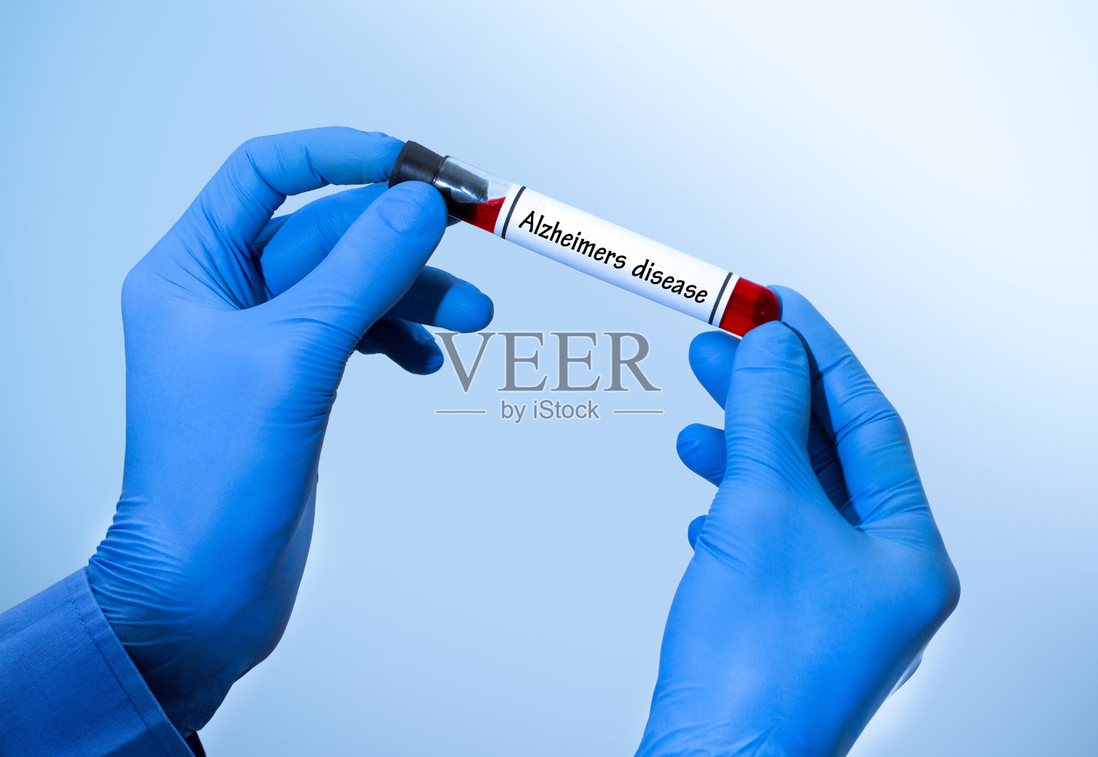 老年痴呆症病测试照片摄影图片