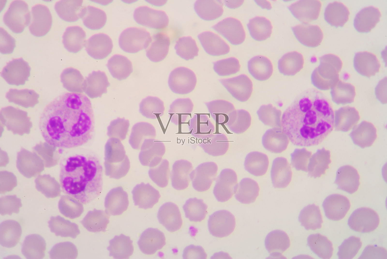 血涂片照片摄影图片
