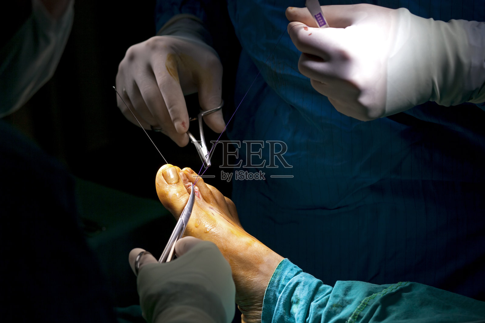 人体足部操作4照片摄影图片