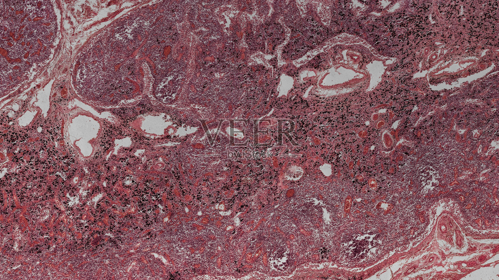 人类淋巴结细胞在显微镜下照片摄影图片