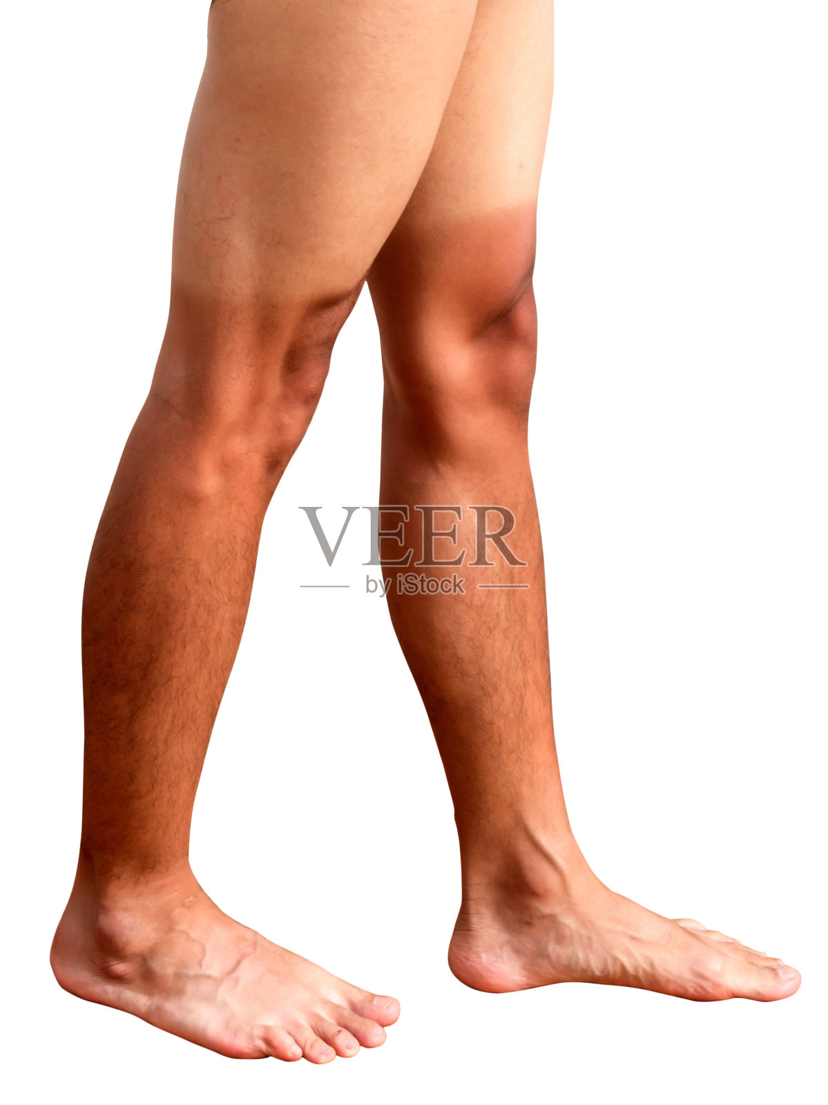 晒成双色皮肤的男人的腿照片摄影图片