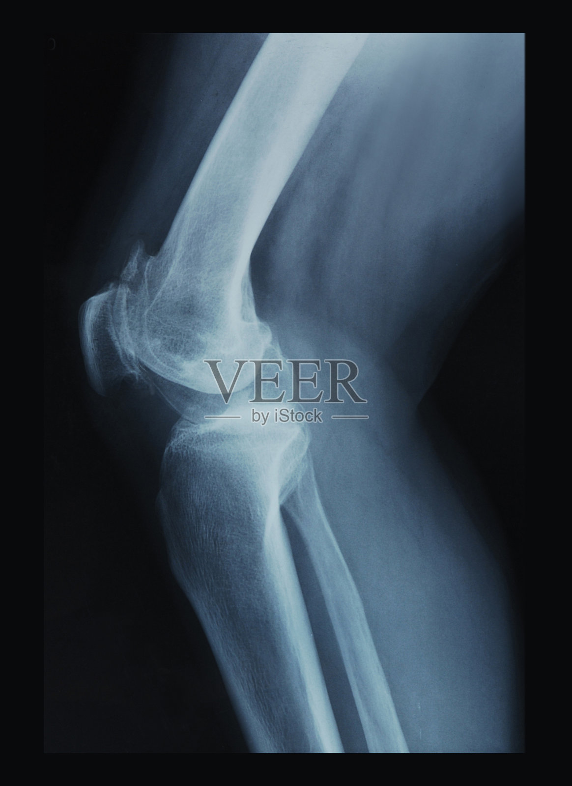 膝盖X光片照片摄影图片