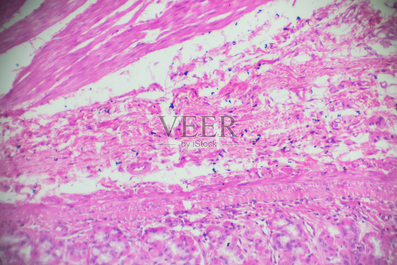 stomatch活检显微镜照片摄影图片