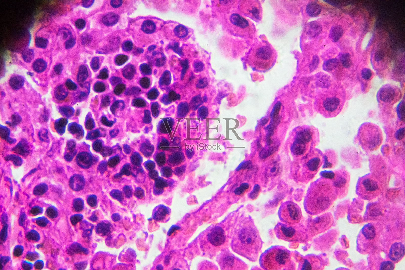 光镜下慢性肺充血照片摄影图片
