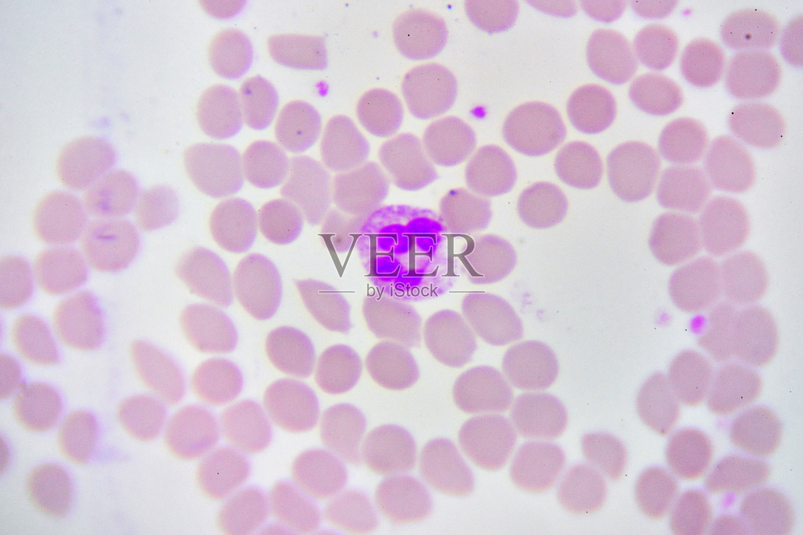 白细胞照片摄影图片