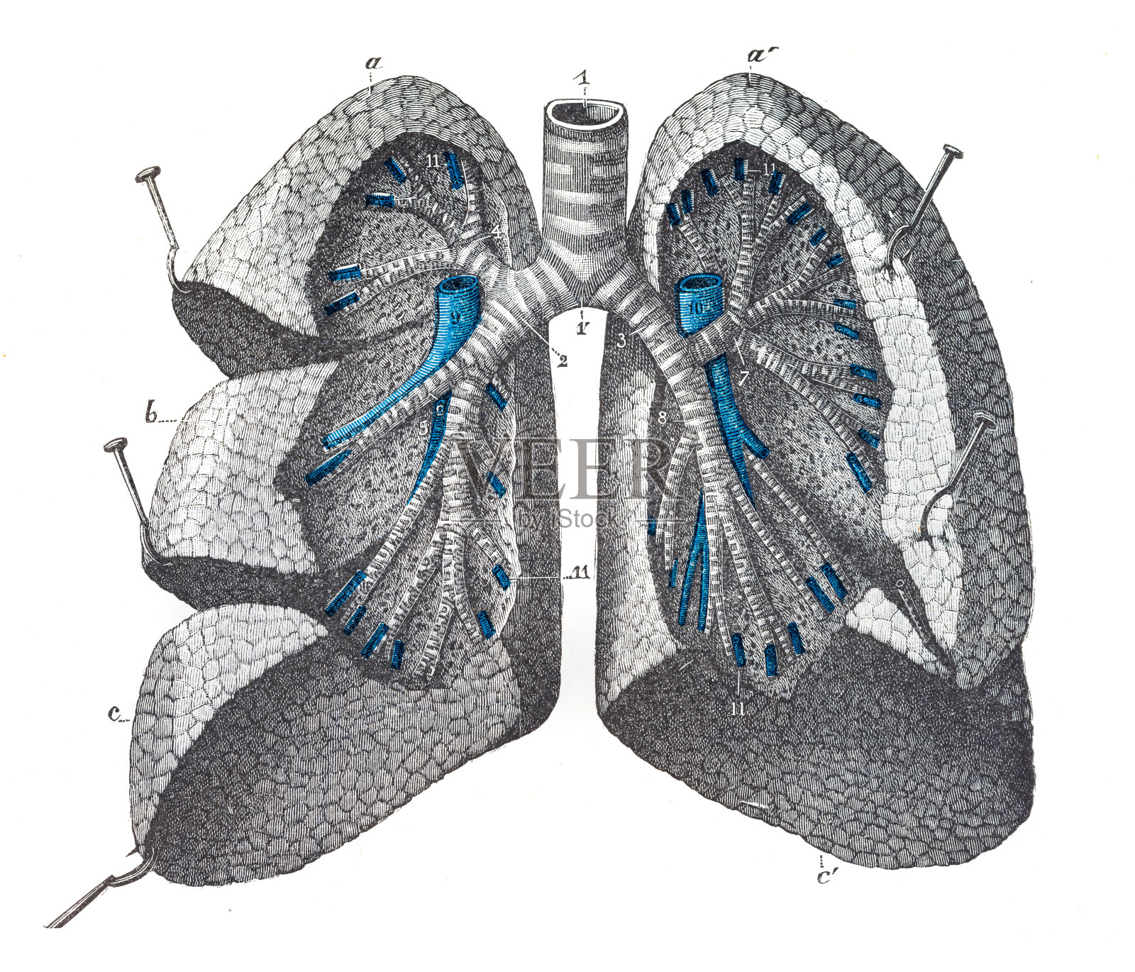肺肿块雕刻1899插画图片素材