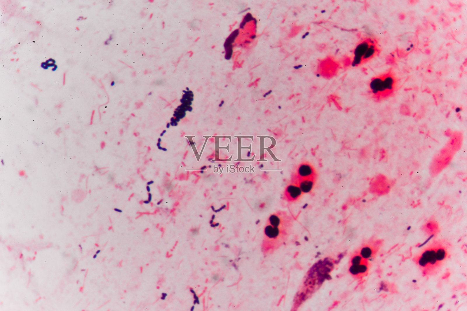 连锁医学背景中的细菌细胞革兰氏阳性球菌。照片摄影图片