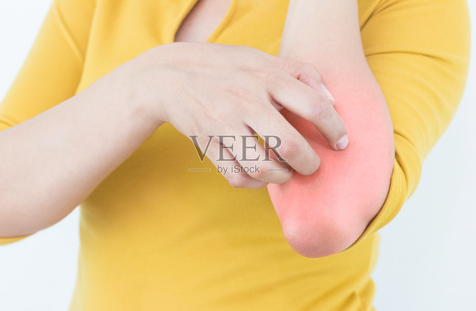 女性挠痒肘部表面，保健理念。照片摄影图片