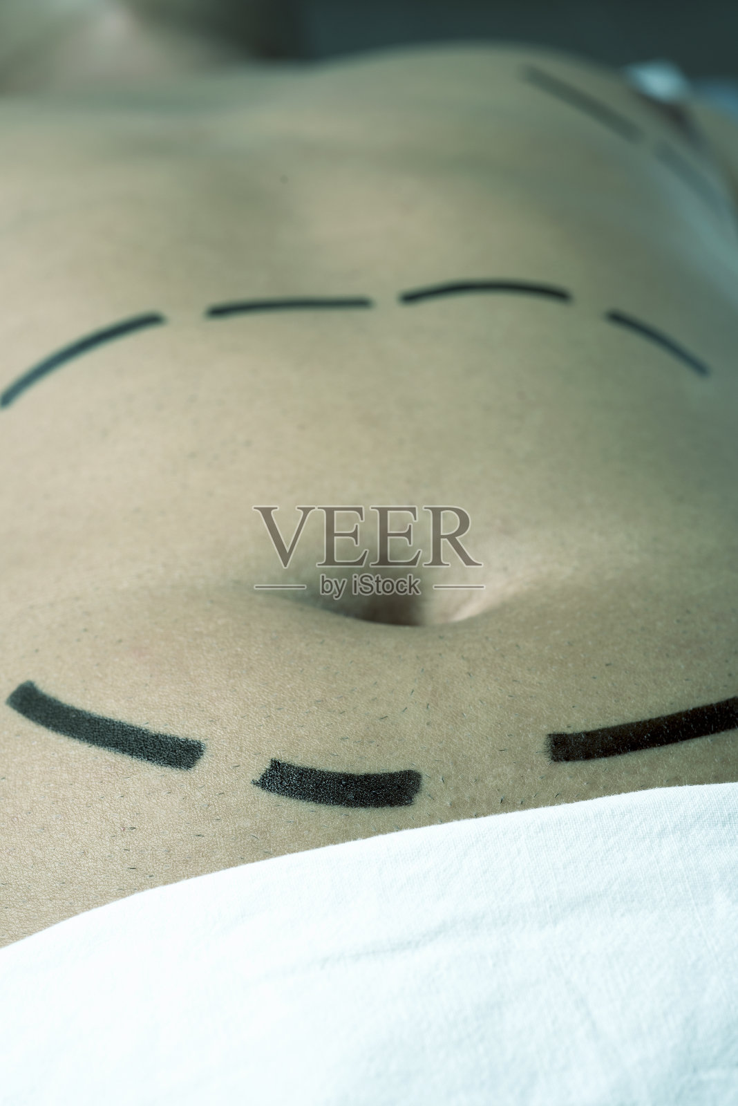 正在做整形手术或抽脂的男人照片摄影图片