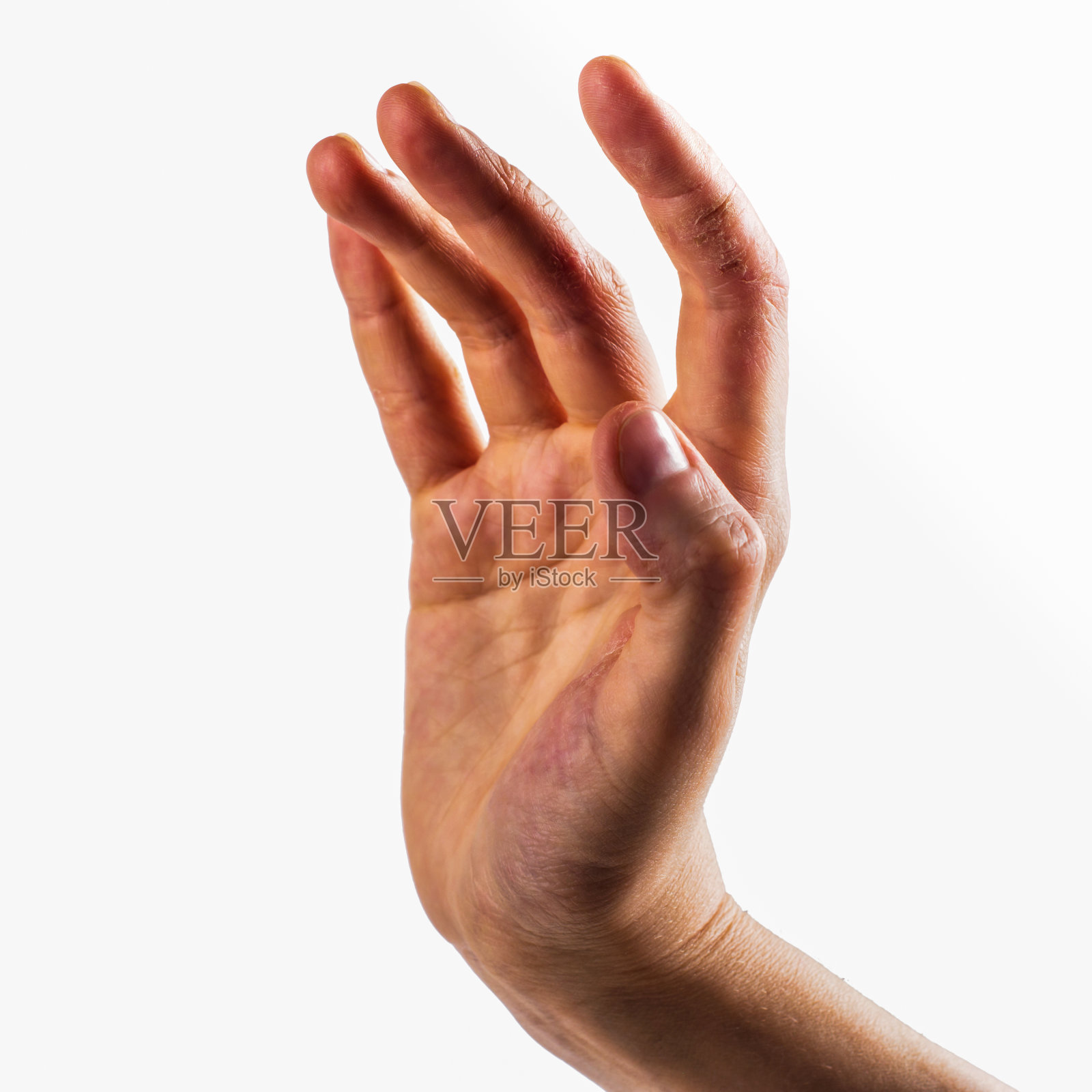 女性的手，皮肤非常干燥照片摄影图片