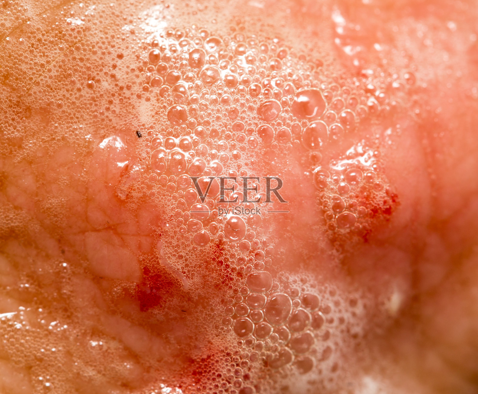 皮肤上有过氧化氢伤口留下的血照片摄影图片