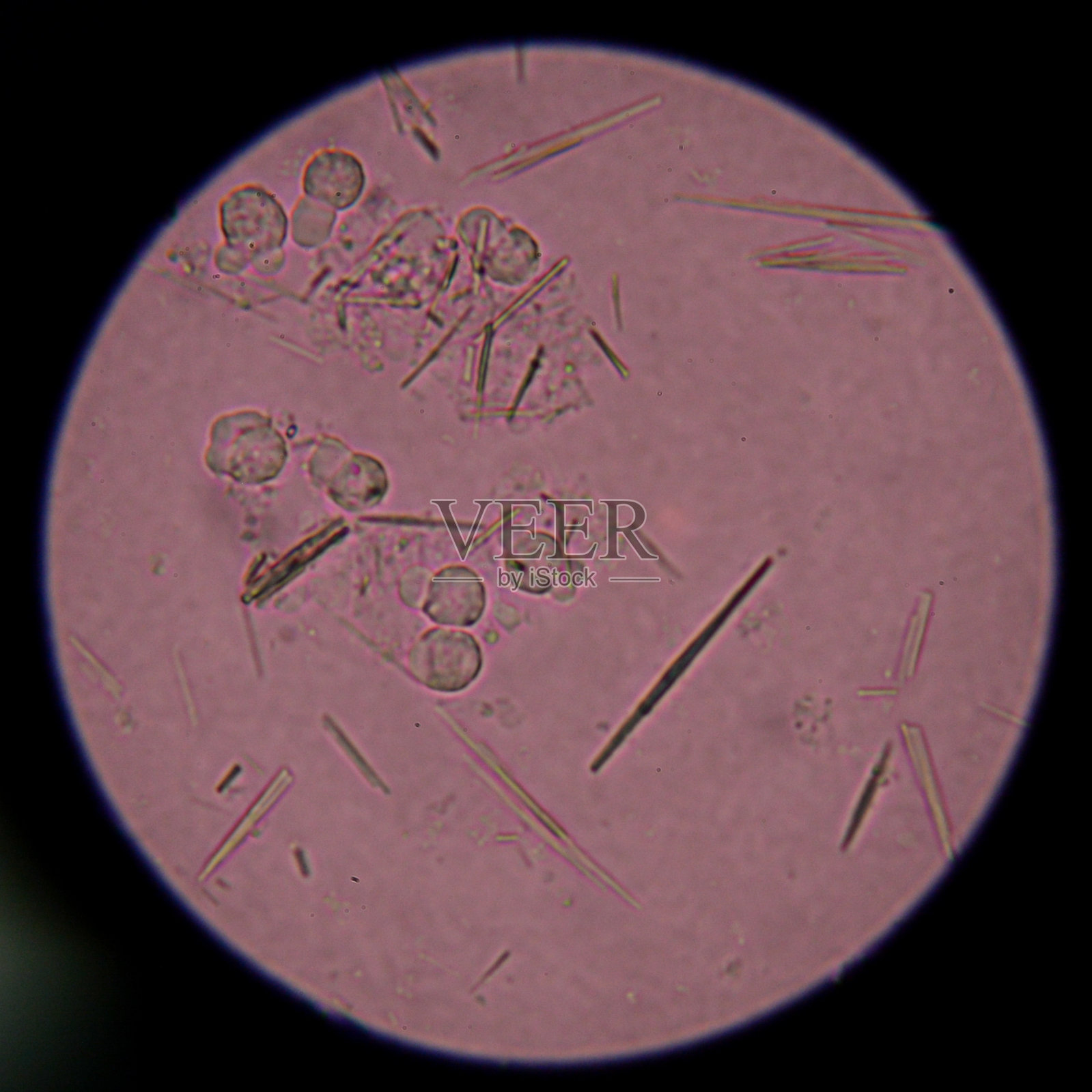 适度尿酸水晶针照片摄影图片