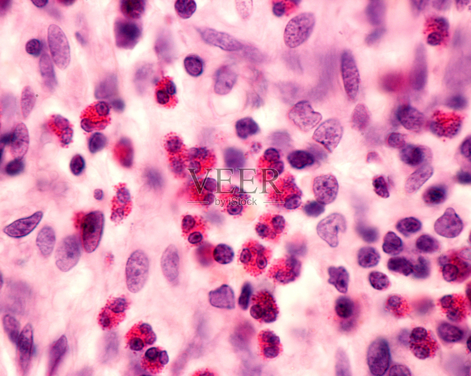 嗜酸性粒细胞粒细胞照片摄影图片