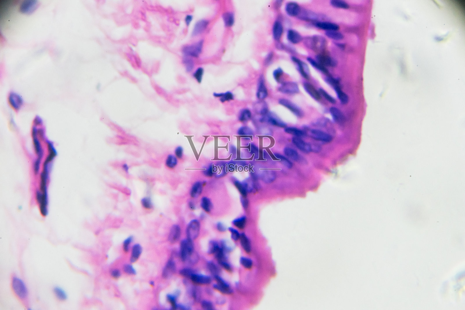 人肺活检镜检照片摄影图片