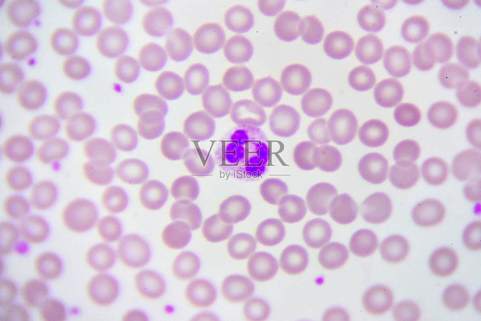 白细胞照片摄影图片