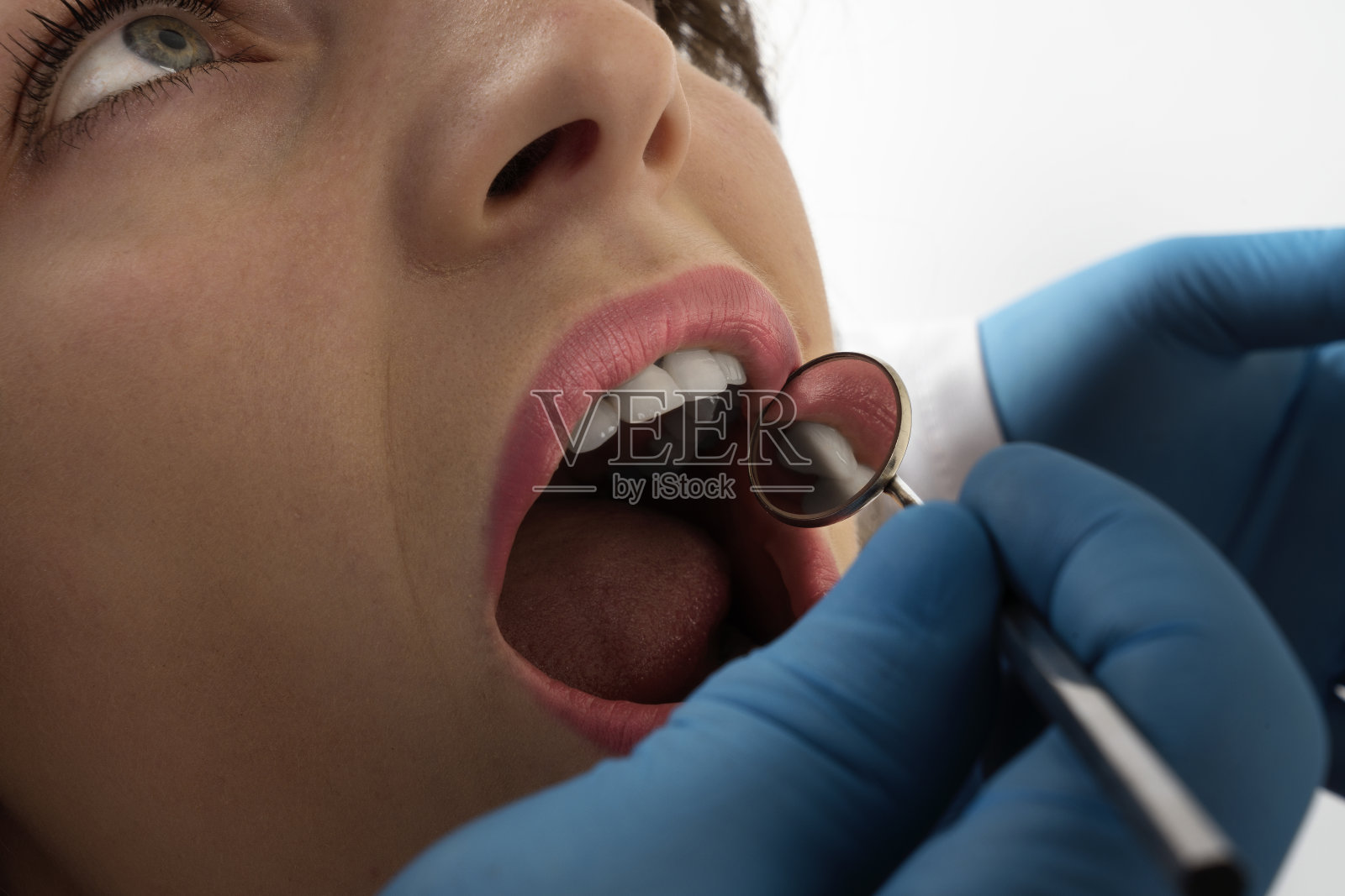 儿童牙科检查照片摄影图片