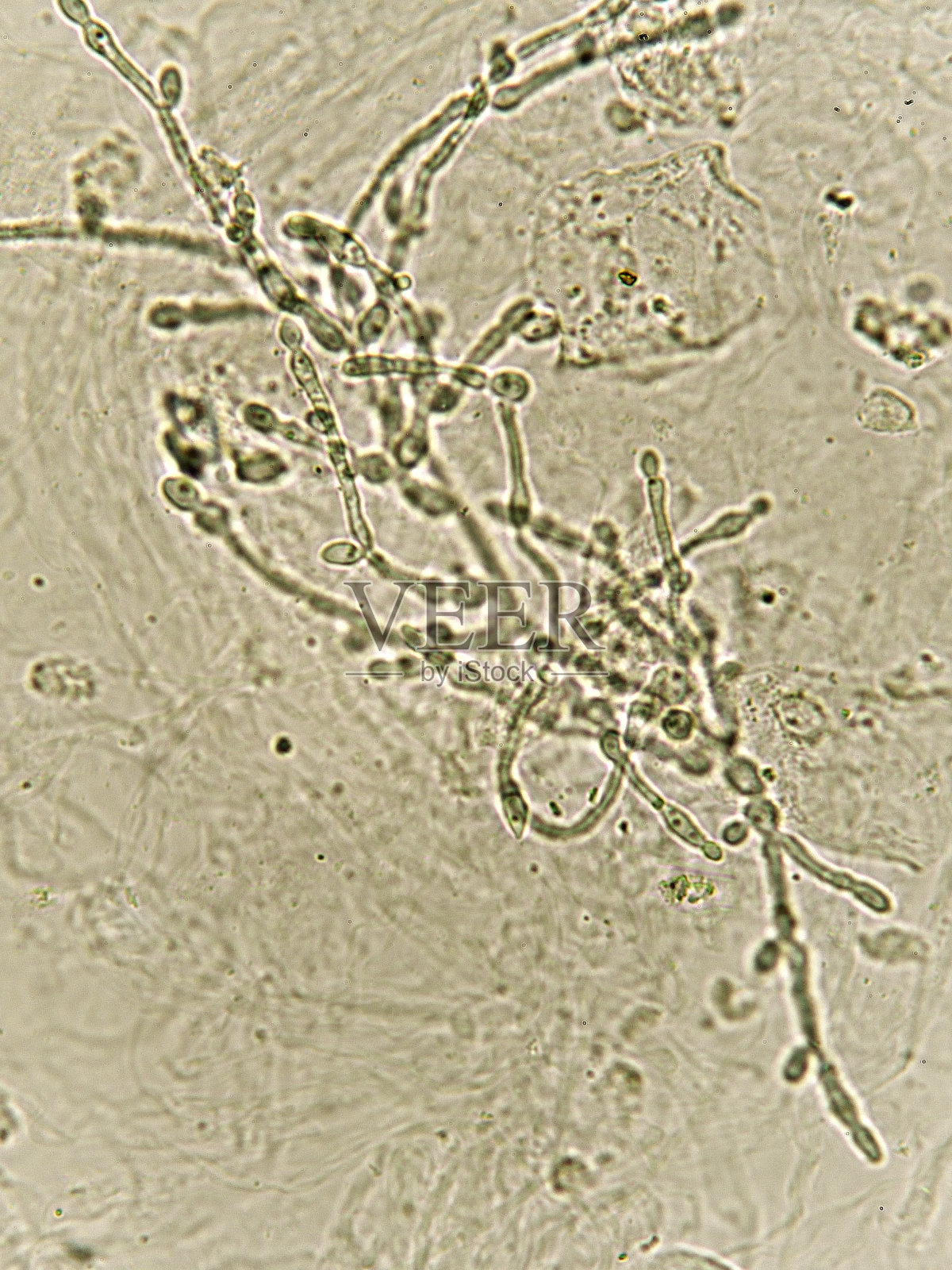 尿中的假菌丝和芽殖酵母细胞照片摄影图片