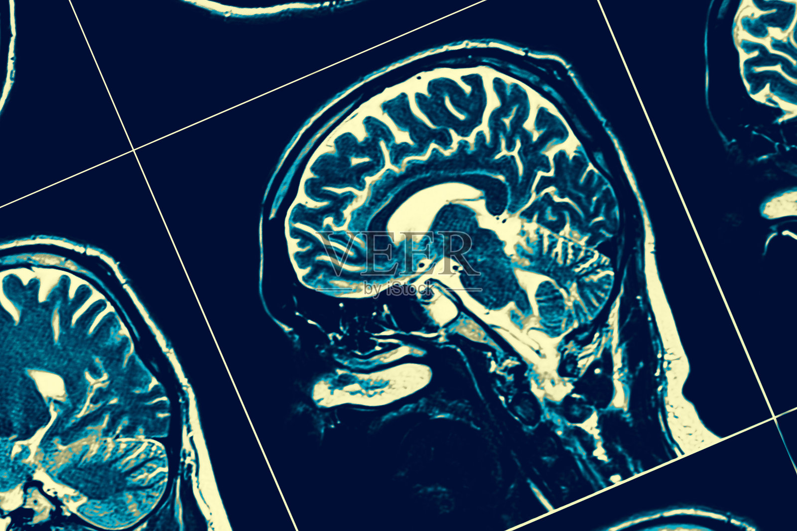 脑矢状面照片摄影图片