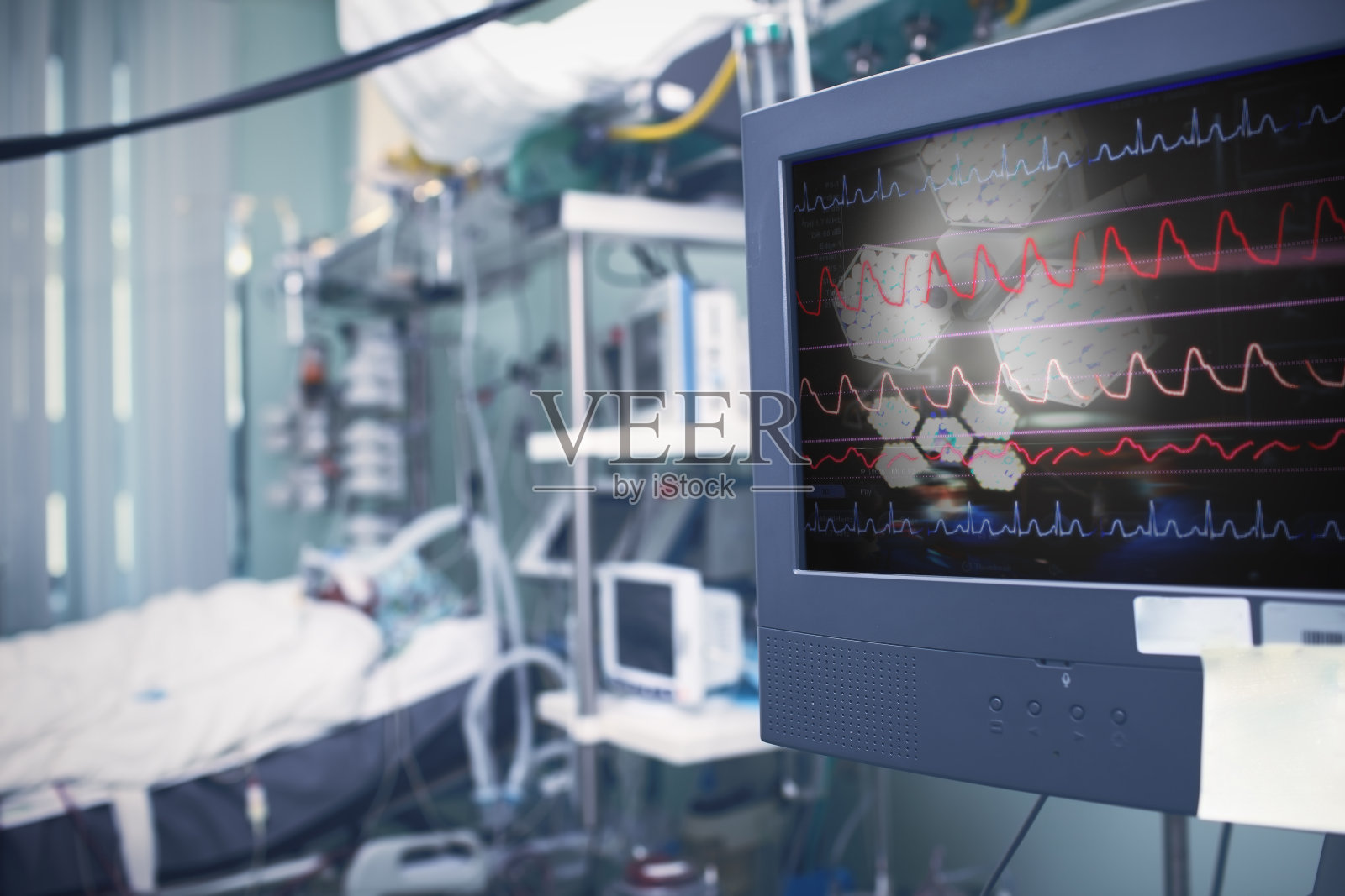 重症手术后在重症监护室的病人照片摄影图片