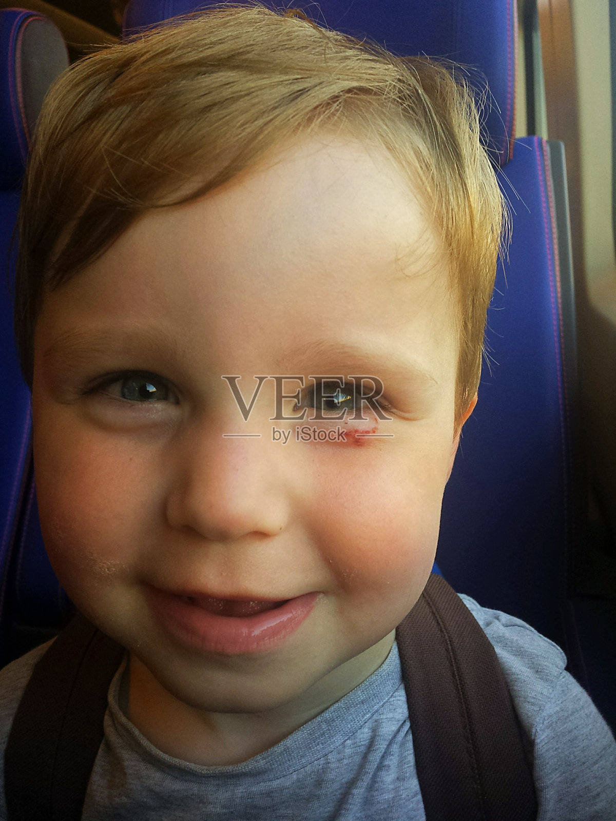 眼睛受伤的小男孩微笑着做鬼脸照片摄影图片