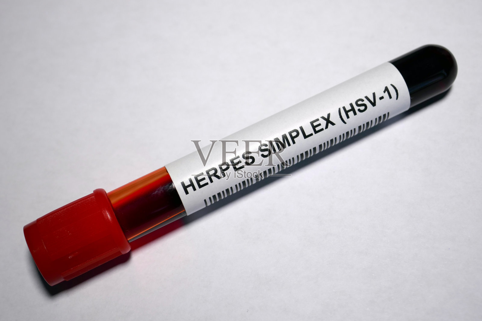 1型单纯疱疹病毒照片摄影图片