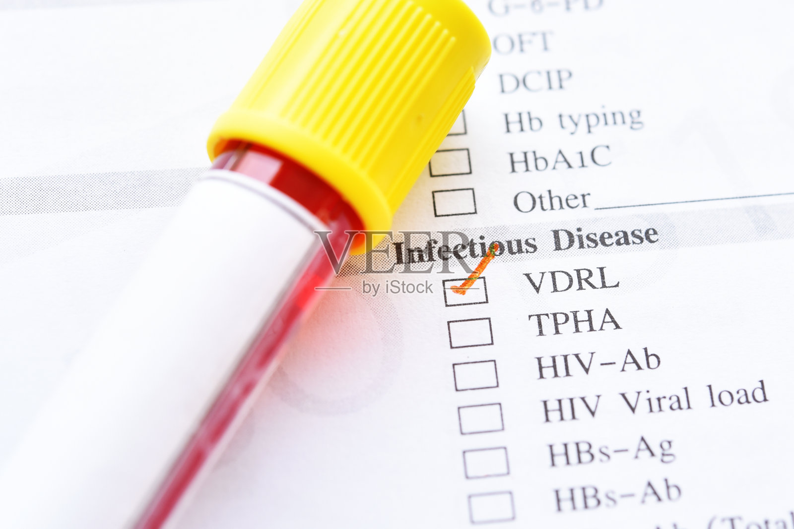 VDRL检测血样管照片摄影图片