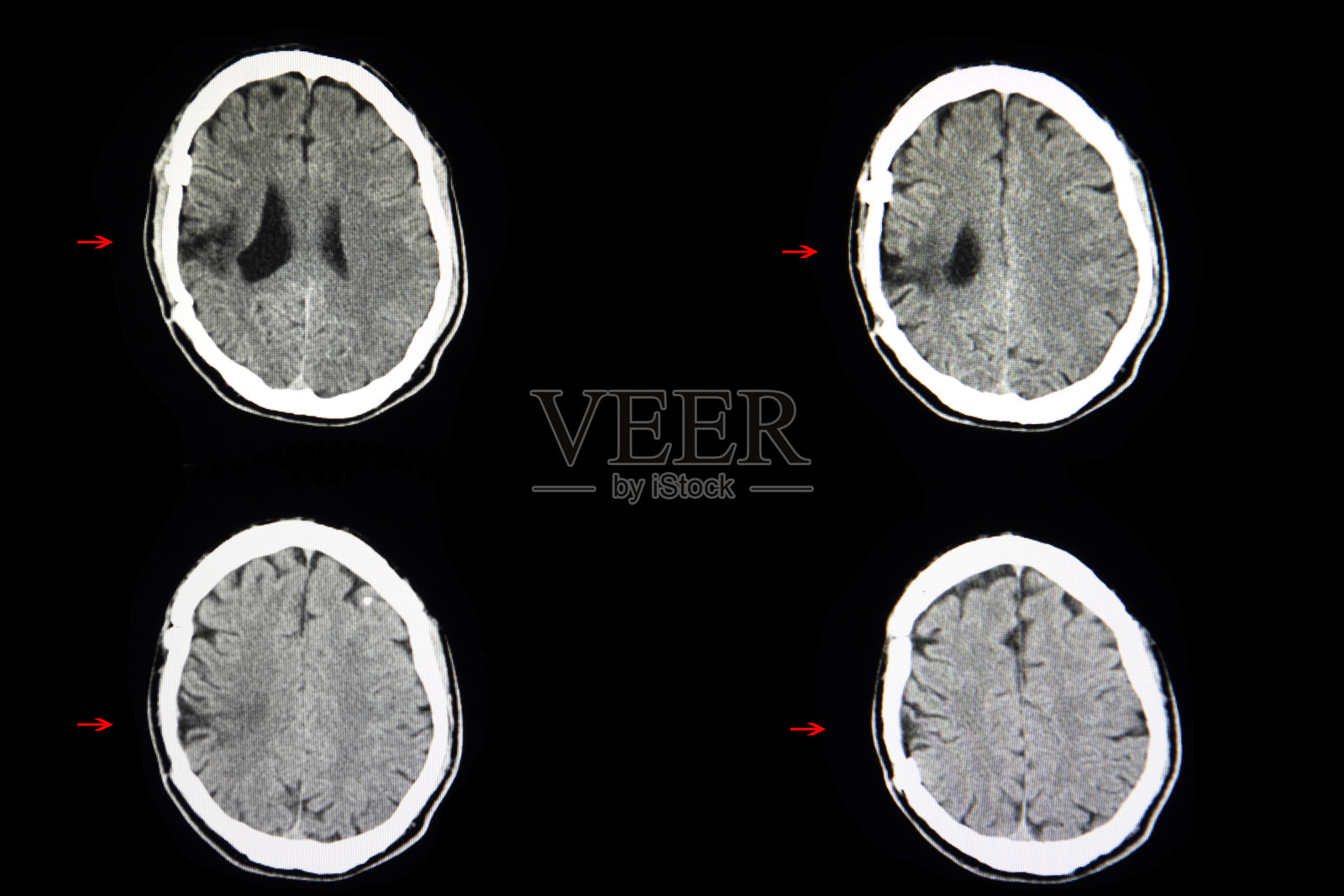 malacy大脑照片摄影图片