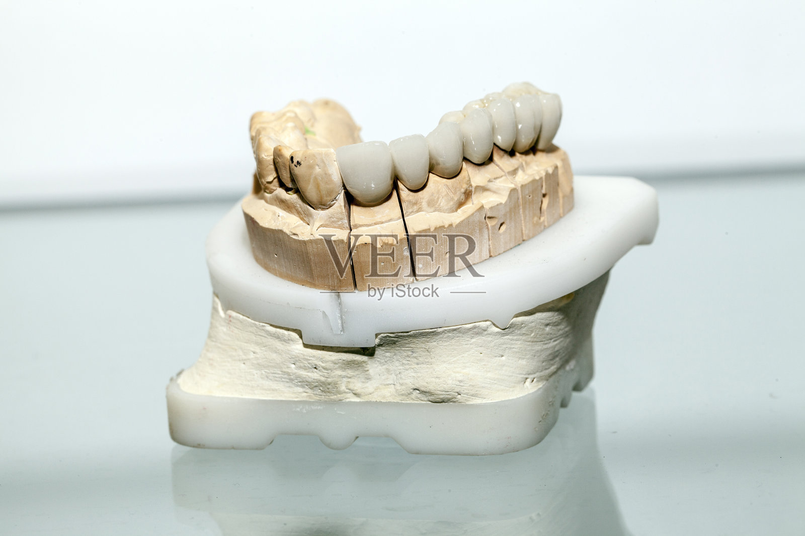 牙科商店的锆瓷牙板照片摄影图片