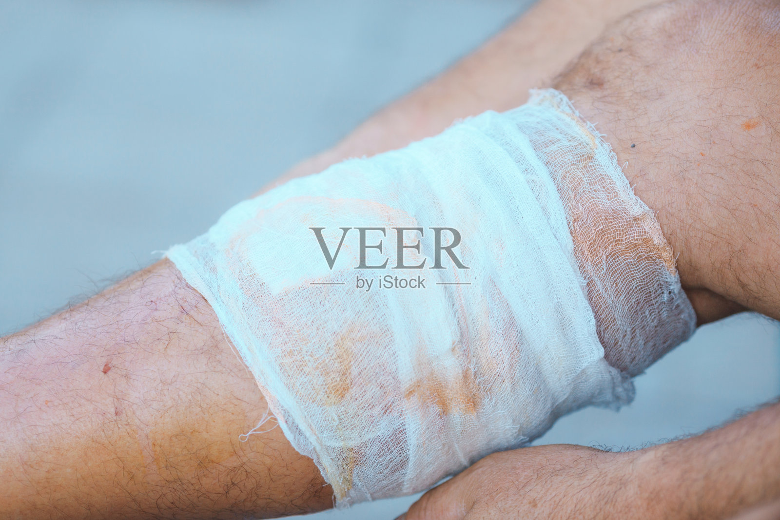 给受伤的腿包扎的过程照片摄影图片