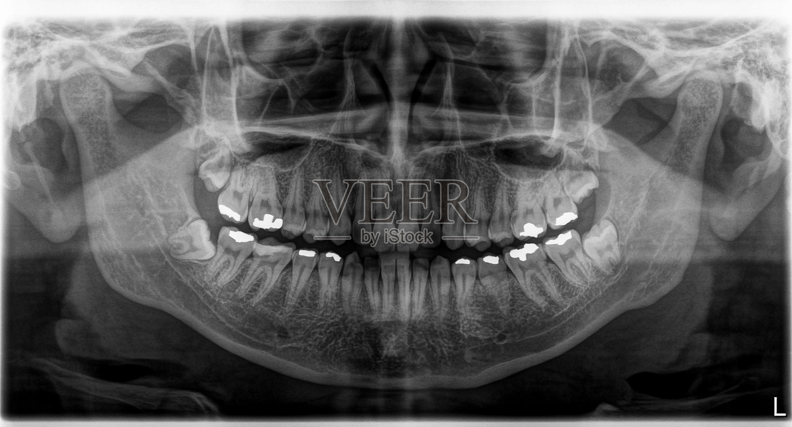 x光片头部和口腔照片摄影图片