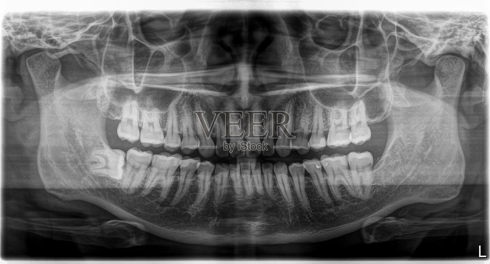 x光片头部和口腔照片摄影图片