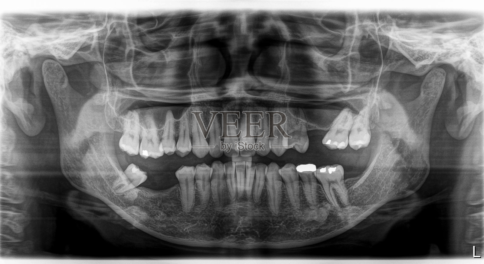 x光片头部和口腔照片摄影图片