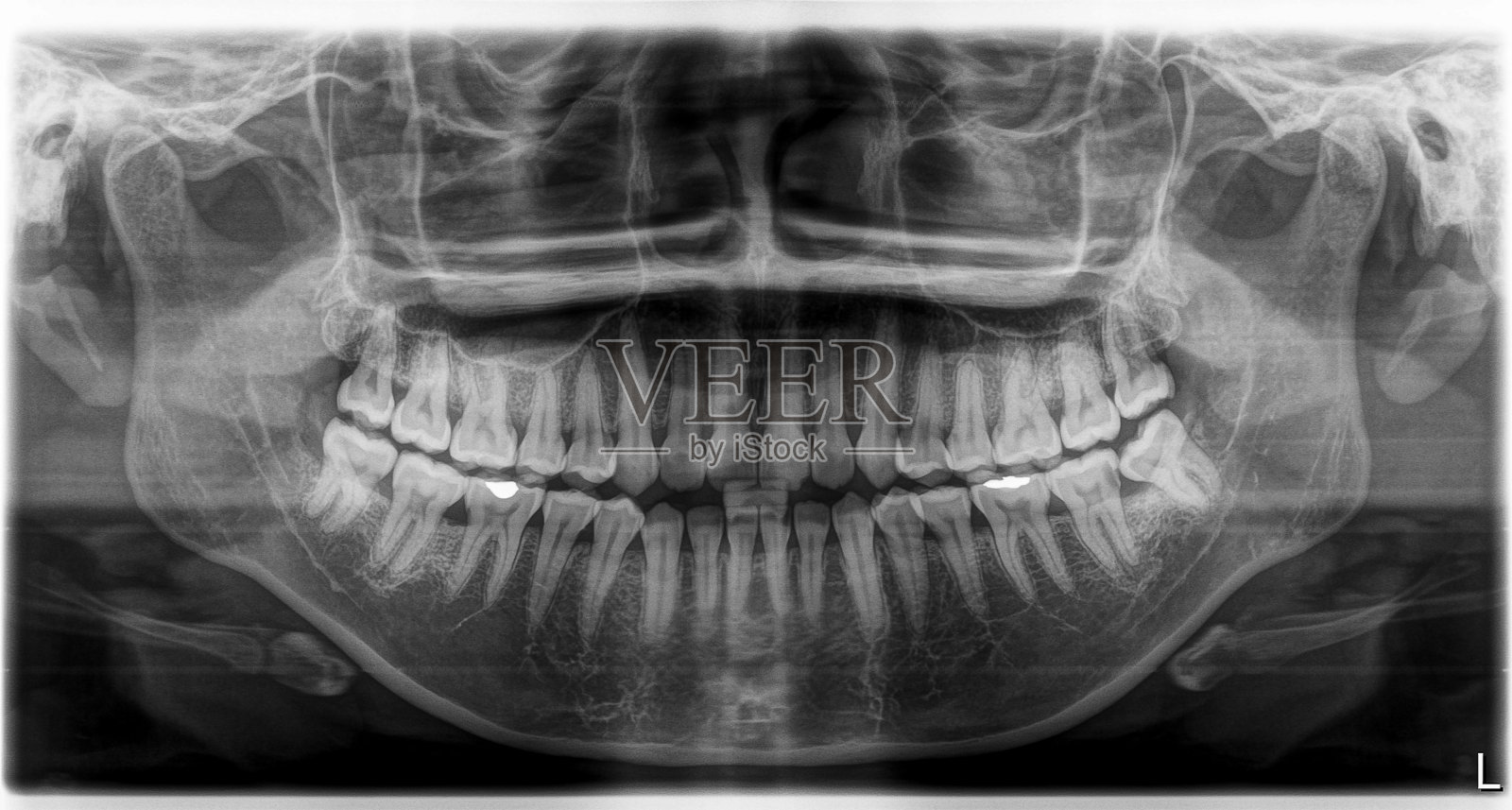 x光片头部和口腔照片摄影图片