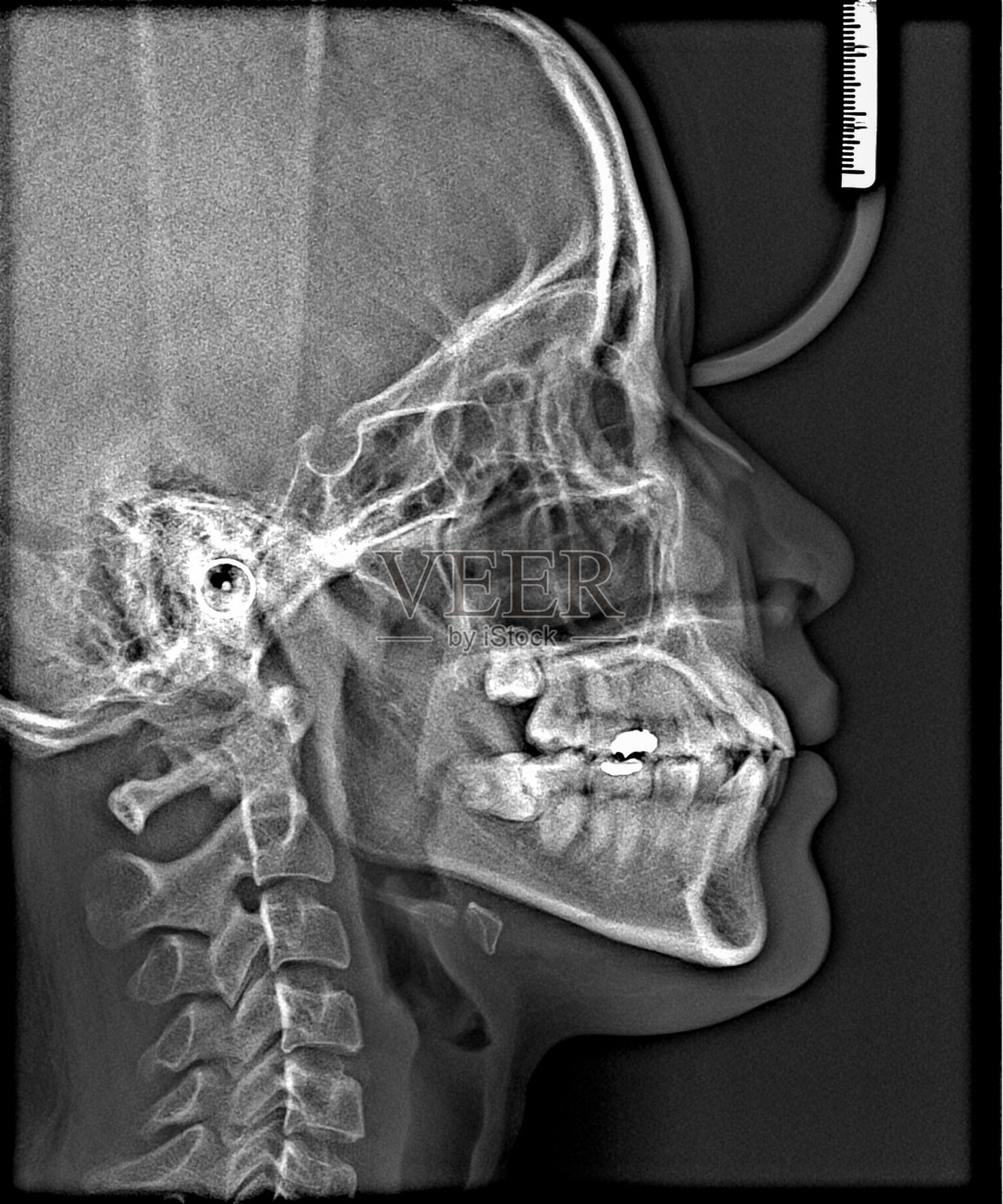 x光片头部和口腔照片摄影图片