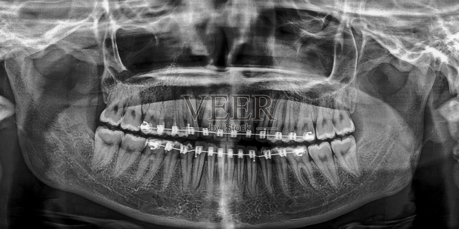 x光片头部和口腔照片摄影图片