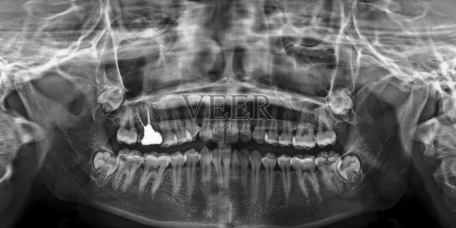 x光片头部和口腔照片摄影图片