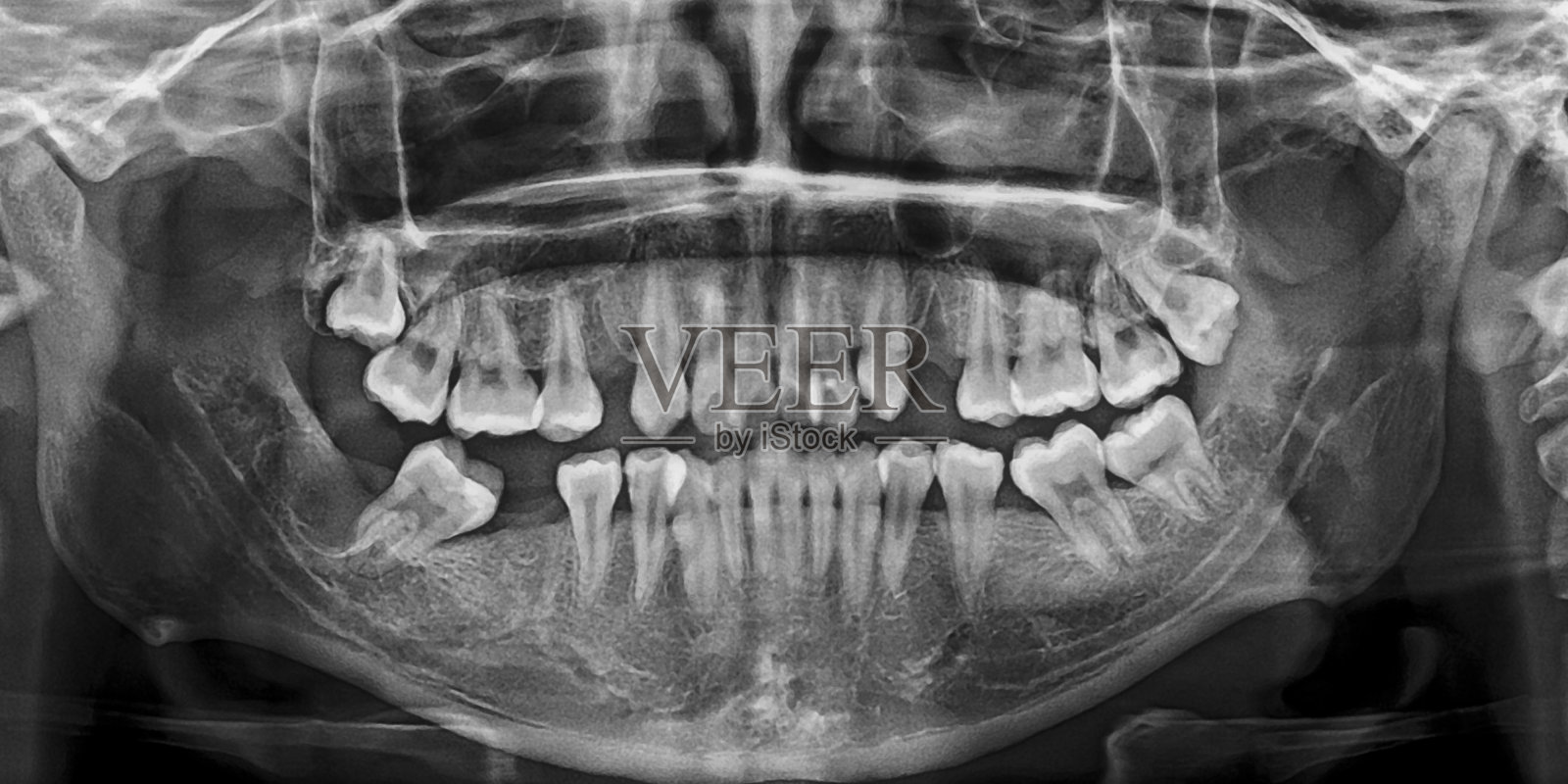 x光片头部和口腔照片摄影图片