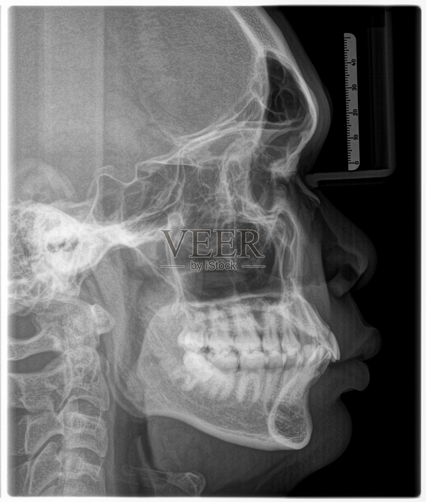 x光片头部和口腔照片摄影图片