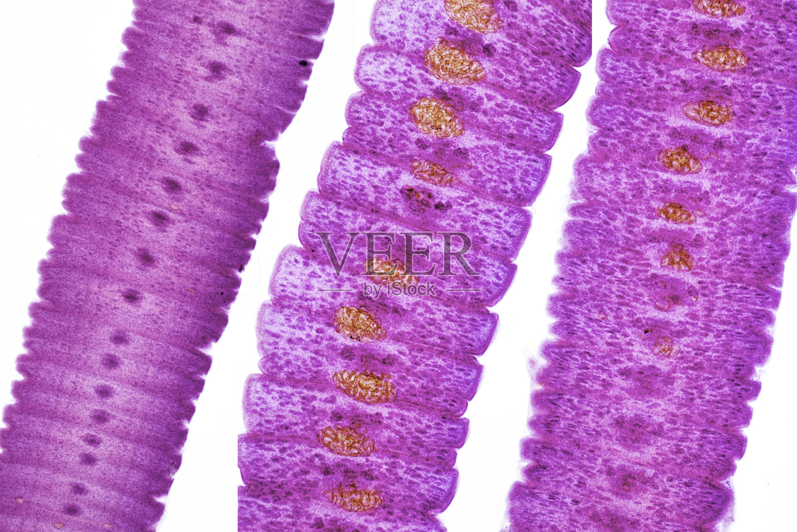 寄生虫的形态和背景，实验室解剖病理学研究。照片摄影图片