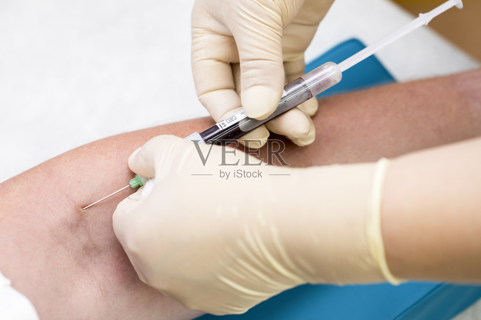 戴着乳胶手套的护士采集血液用于分析或艾滋病毒检测照片摄影图片