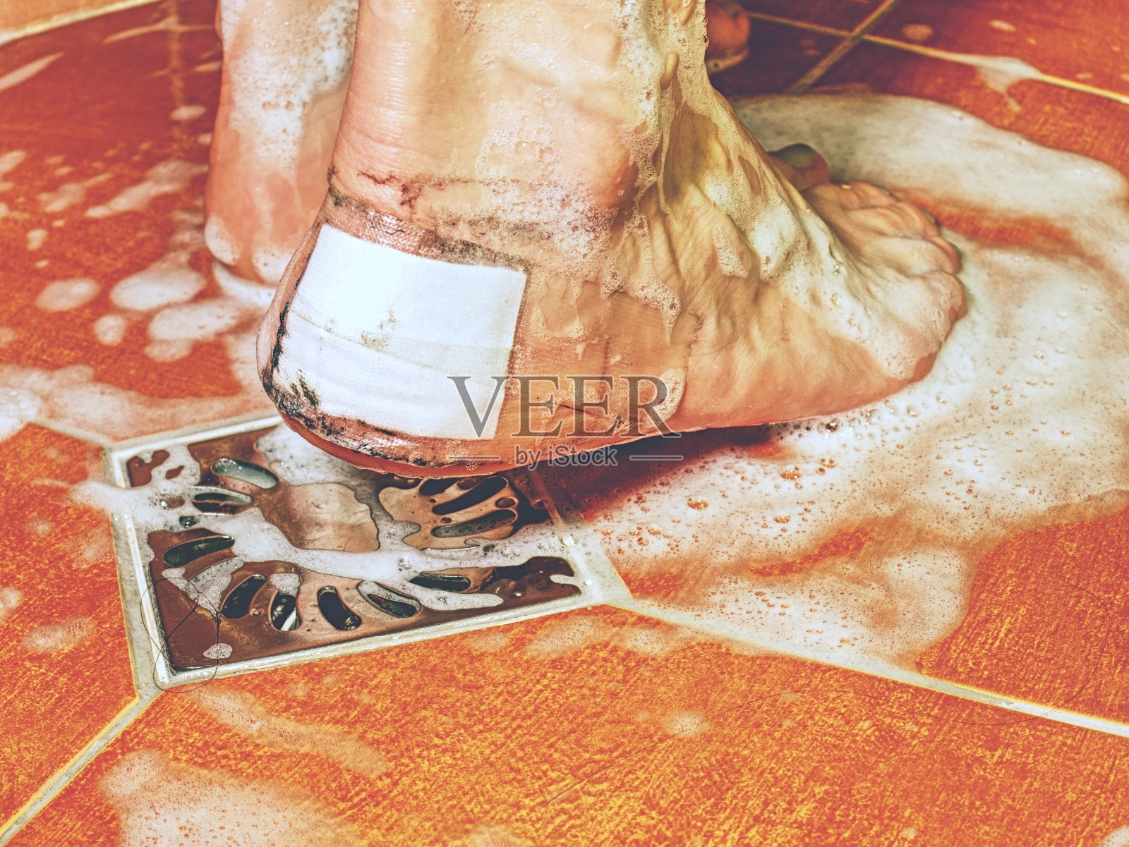 伤足，后跟有白斑。湿脚照片摄影图片