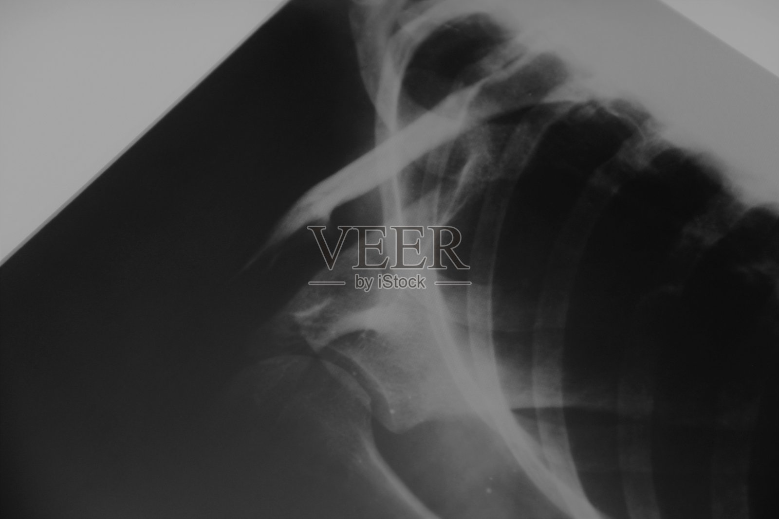 射线照片照片摄影图片