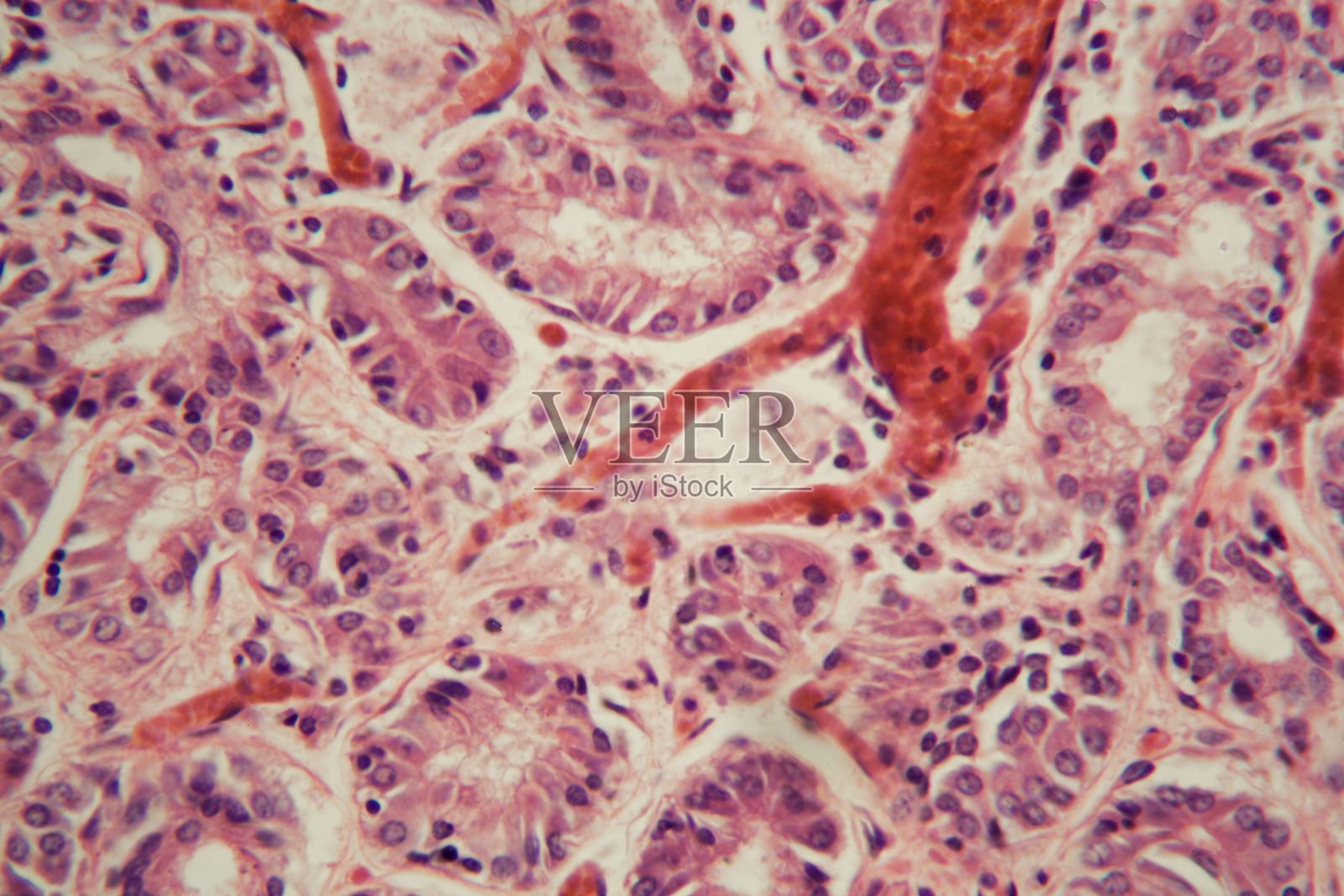 肺栓塞患者肺组织的显微镜观察。照片摄影图片