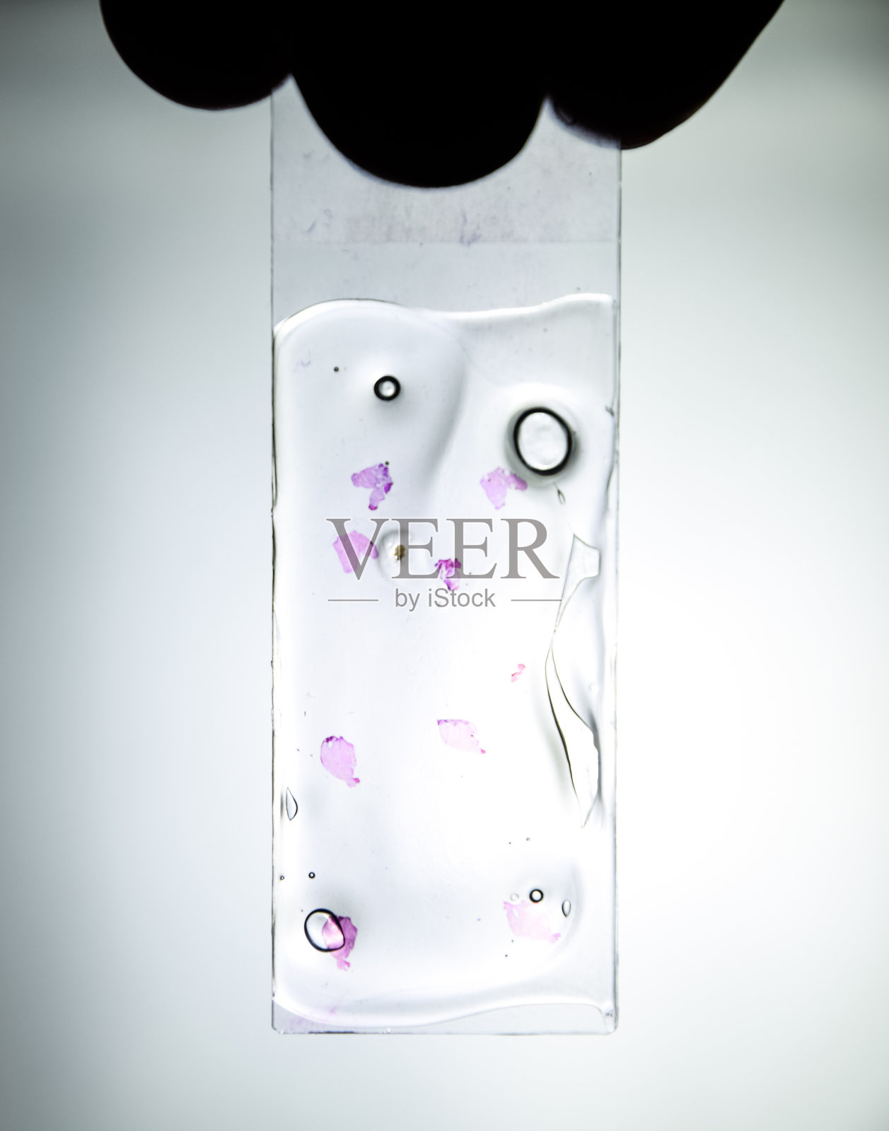 把肿瘤切片放在玻璃下。肿瘤细胞的组织学检查照片摄影图片