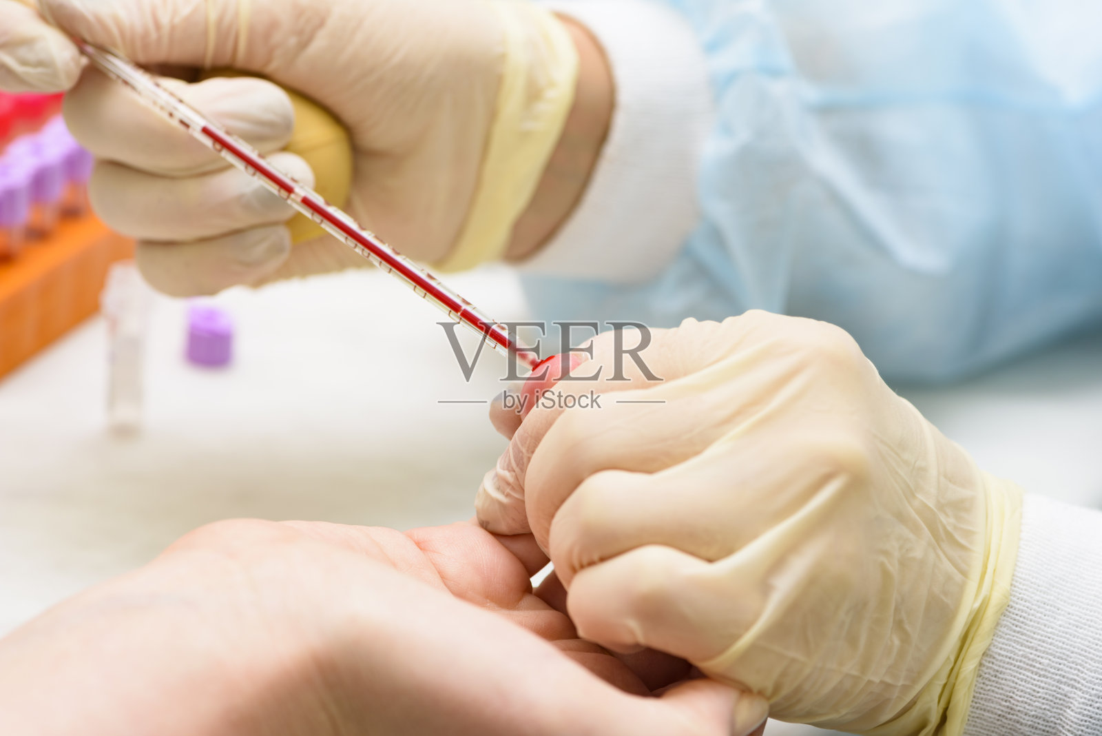 血液测试照片摄影图片