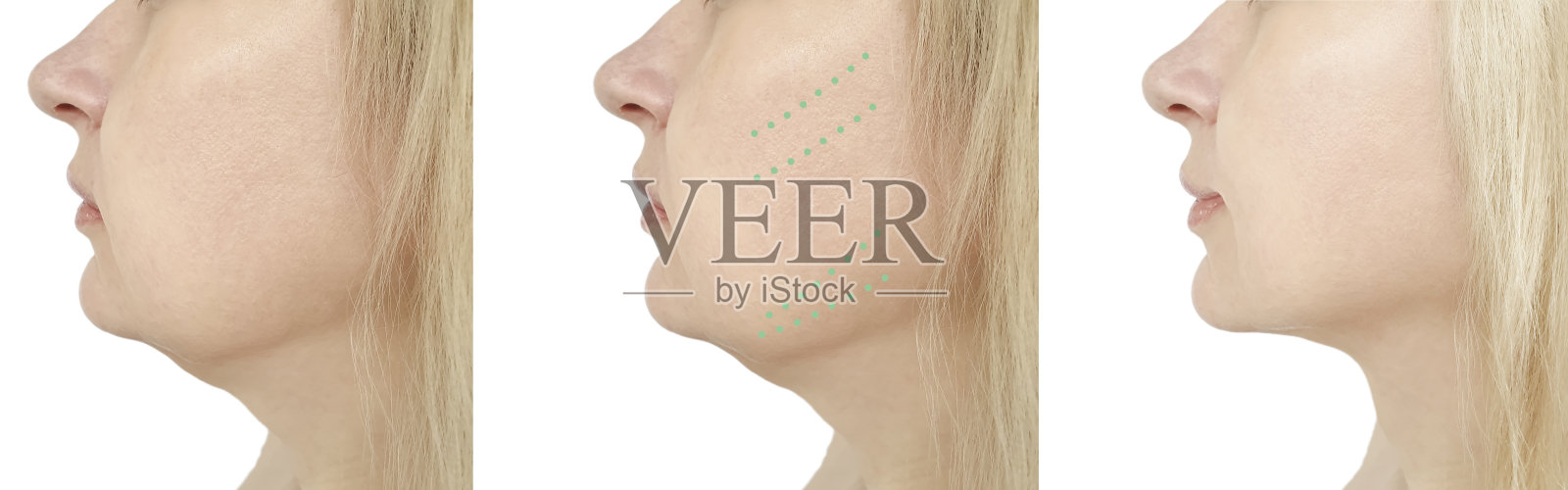 女人的下巴前后程序，修饰照片摄影图片