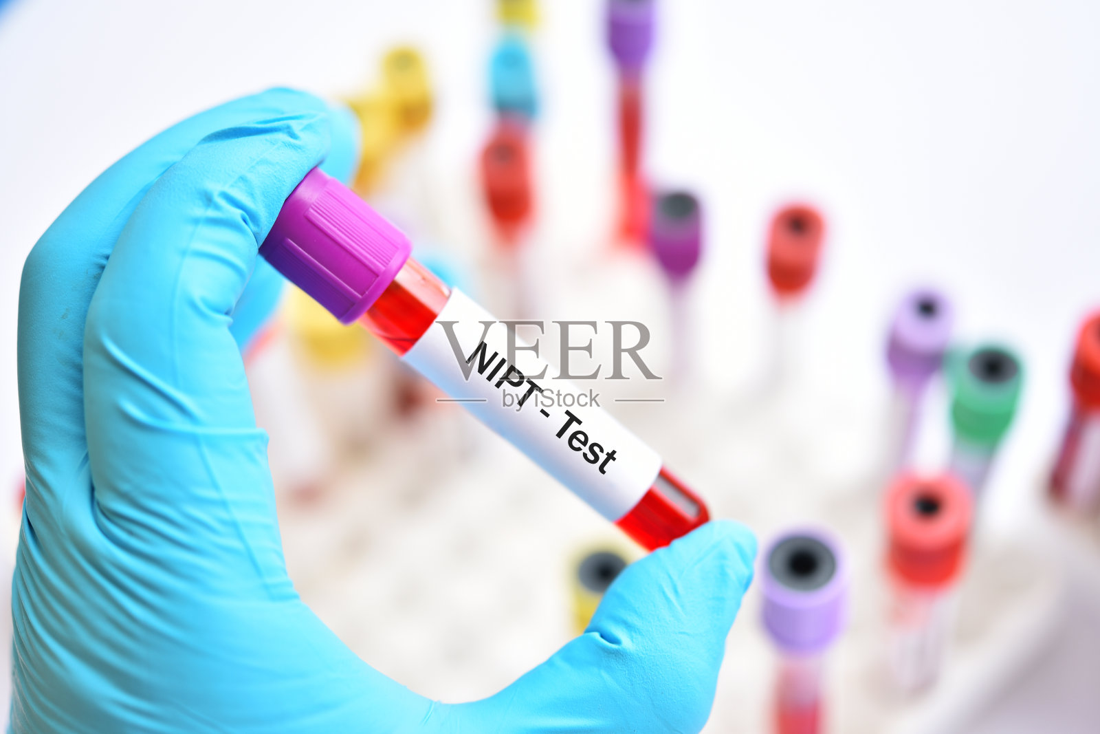 NIPT检测血样照片摄影图片