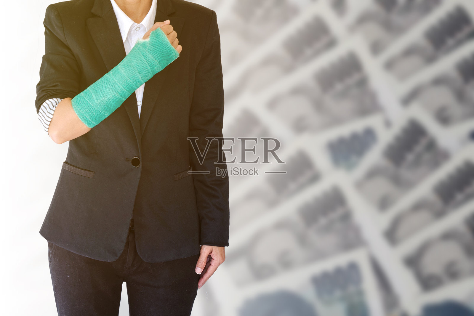 受伤的女商人手骨折，绿色石膏站在模糊的日元钞票上，保险概念。照片摄影图片