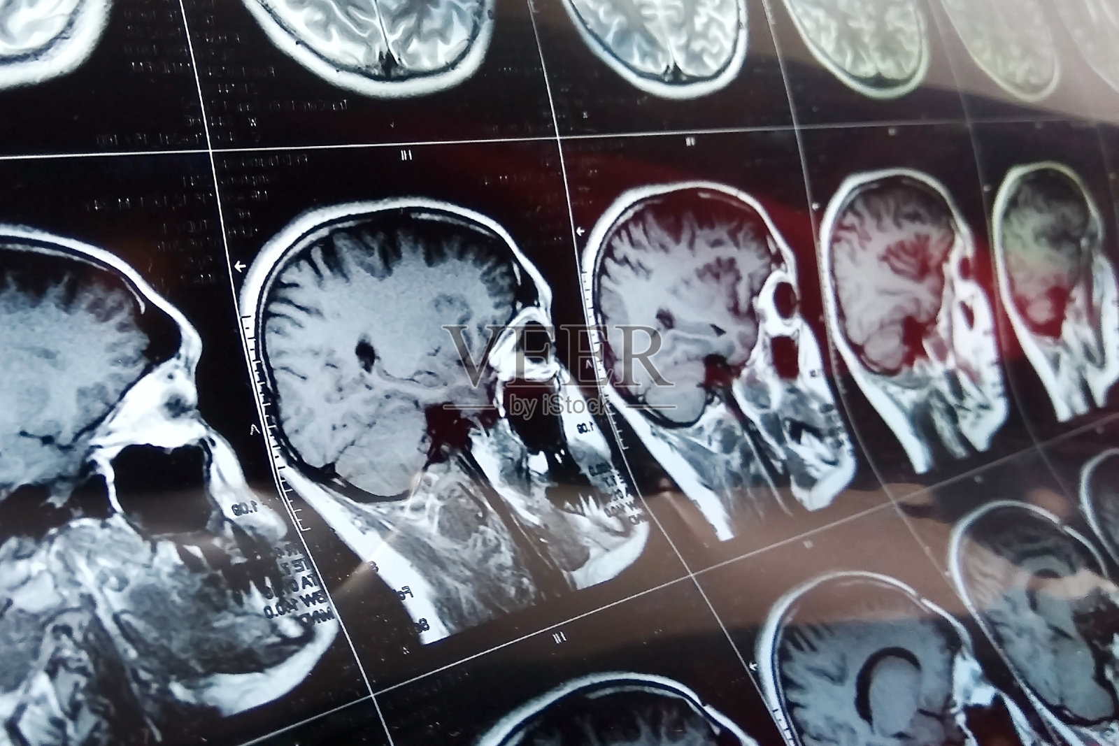 用颅骨对大脑进行磁共振扫描。MRI头部扫描，背景为深蓝色照片摄影图片